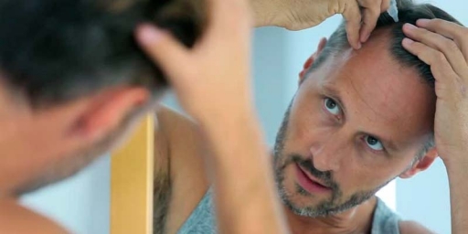Ranking efectividad de los tratamientos médicos para la alopecia androgenética